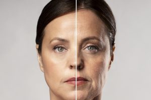 Scopri di più sull'articolo Riduzione delle Rughe con la Medicina Estetica: Un Approccio Moderno alla Gioventù