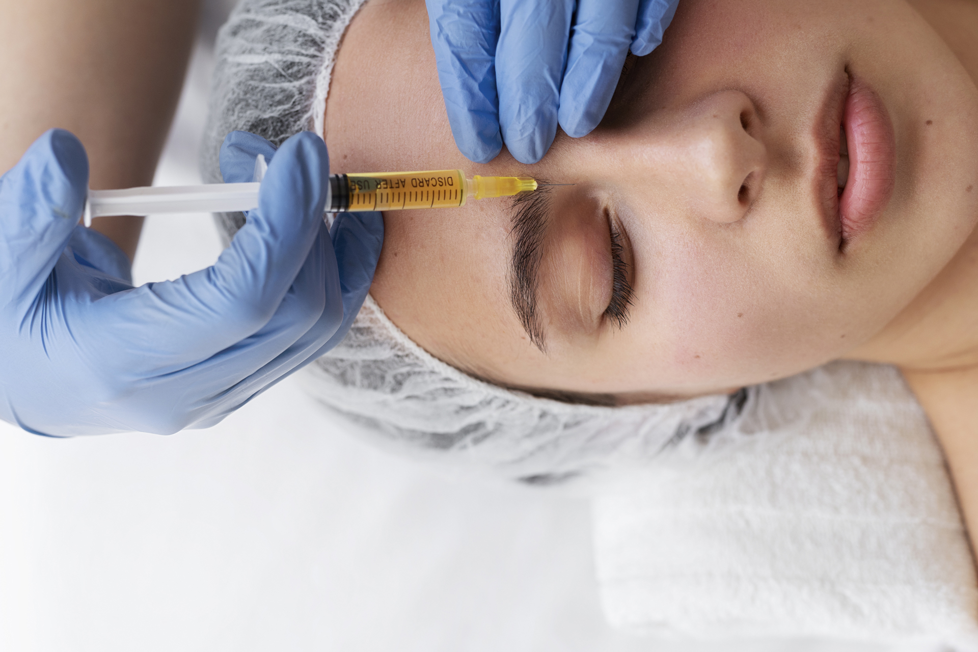 biostimolazione